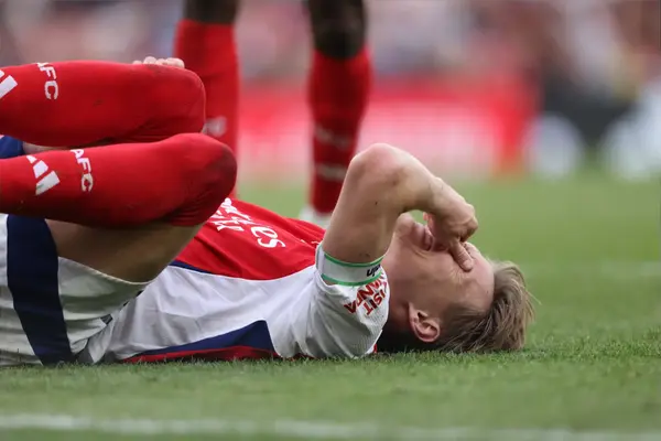 Updates On Martin Odegaard, Jurrien Timber And 6 More: Arsenal Injury News And Expected Return Dates